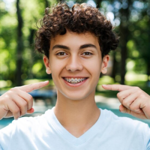 CERAMIC BRACES CERAMIC BRACES