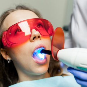 LASER TEETH WHITENING LASER TEETH WHITENING